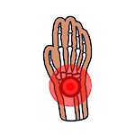 Radiografía de Muñeca