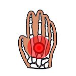 Resonancia Magnética de Mano Unilateral Simple